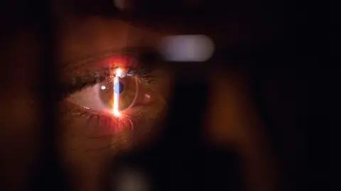 Close-up of an eye examined by a vertical beam of light.